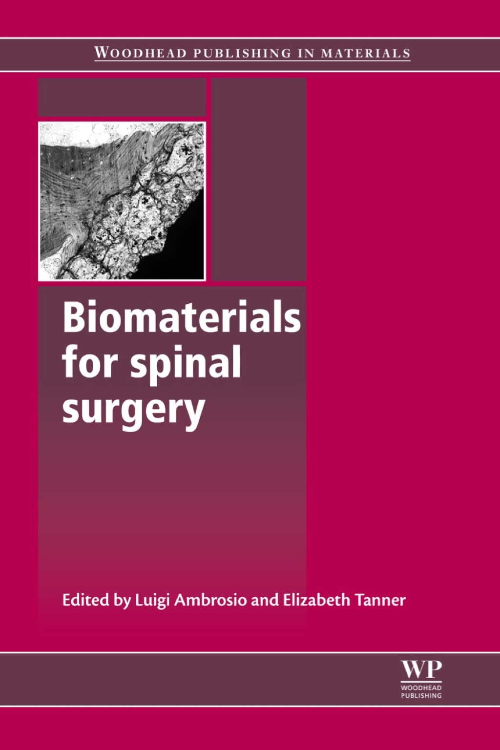 Biomaterials for Spinal Surgery 