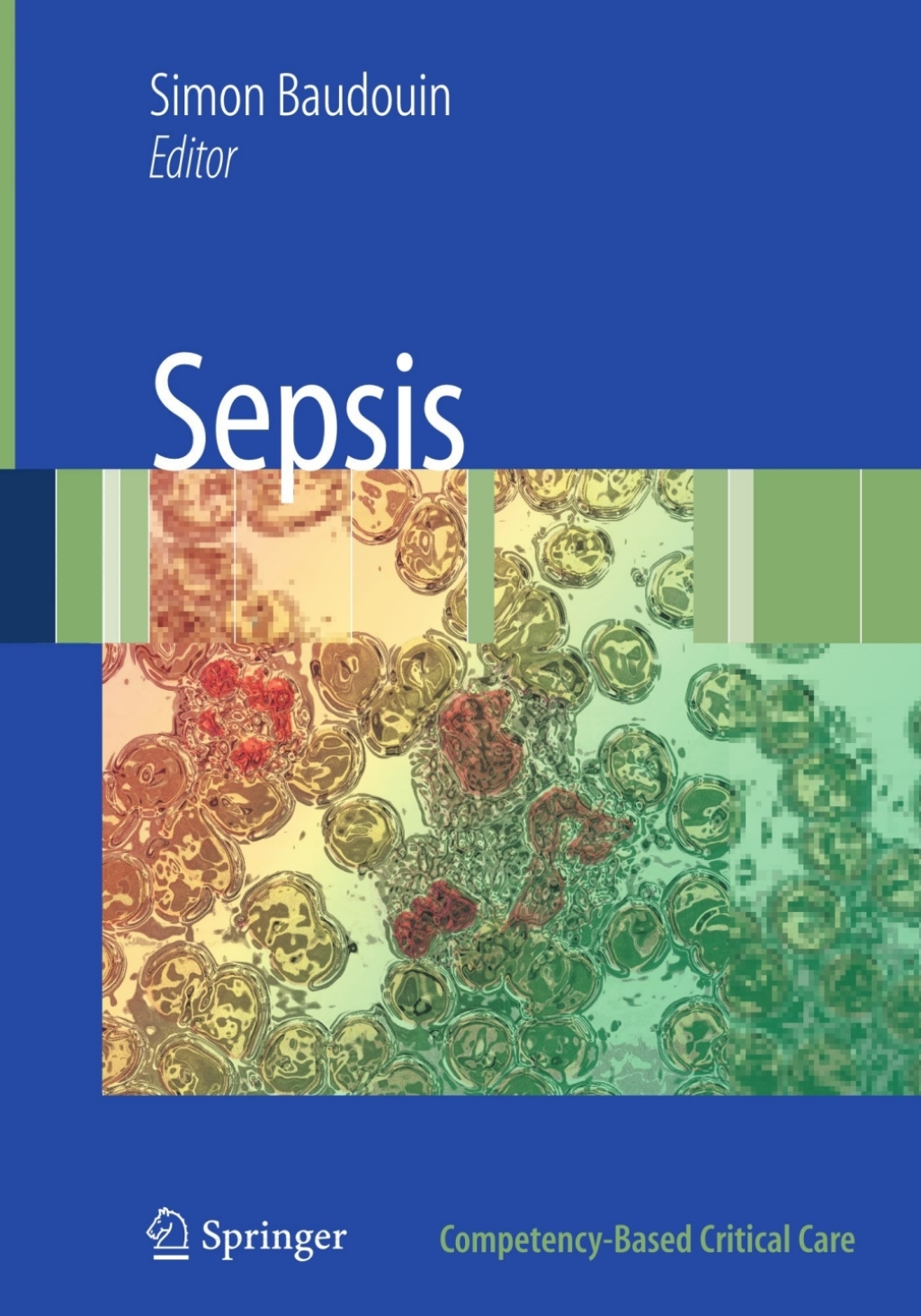 Sepsis 1st Edition