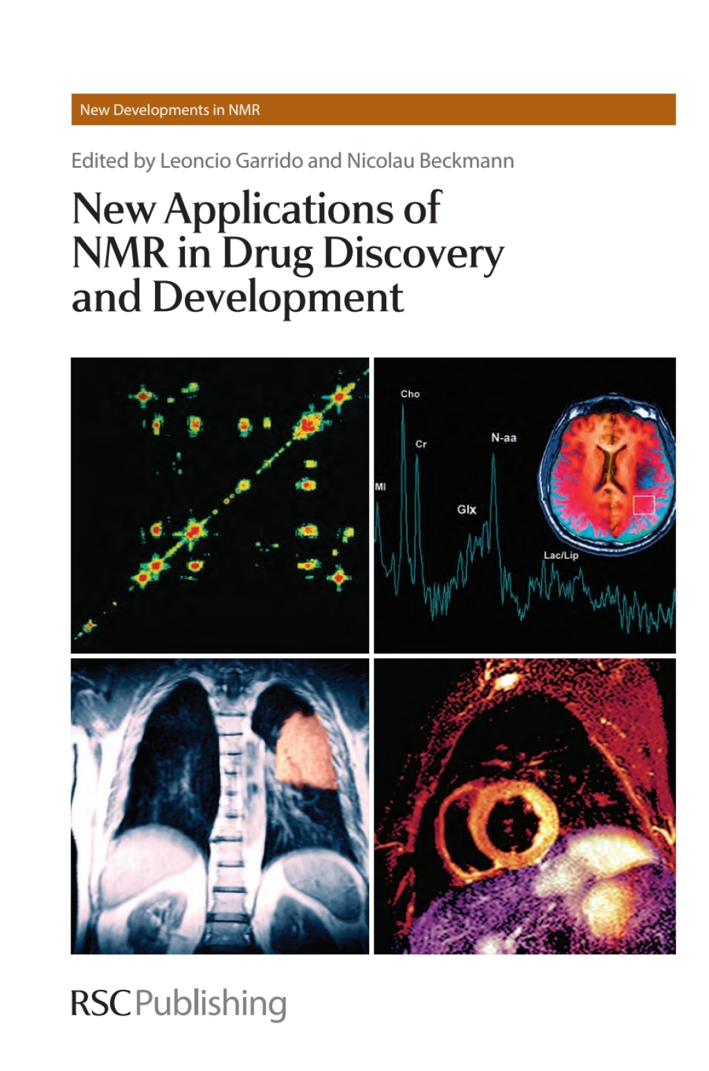 New Applications of NMR in Drug Discovery and Development 1st Edition