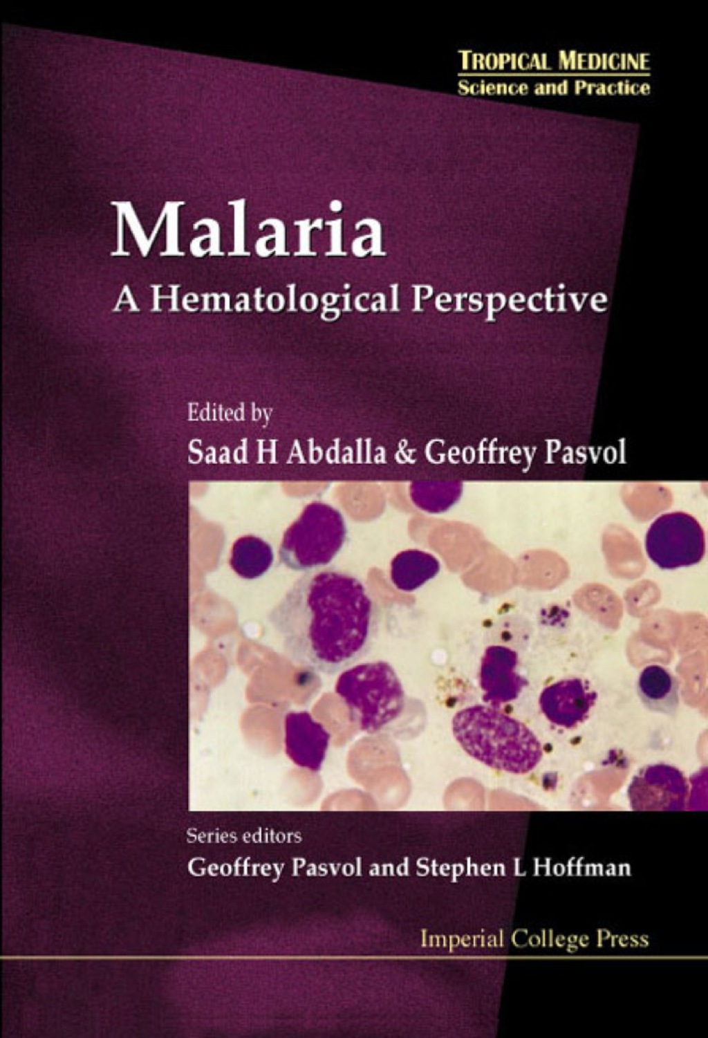 MALARIA:A HAMATOLOGICAL PERSPECTIVE (V4) A Hematological Perspective 