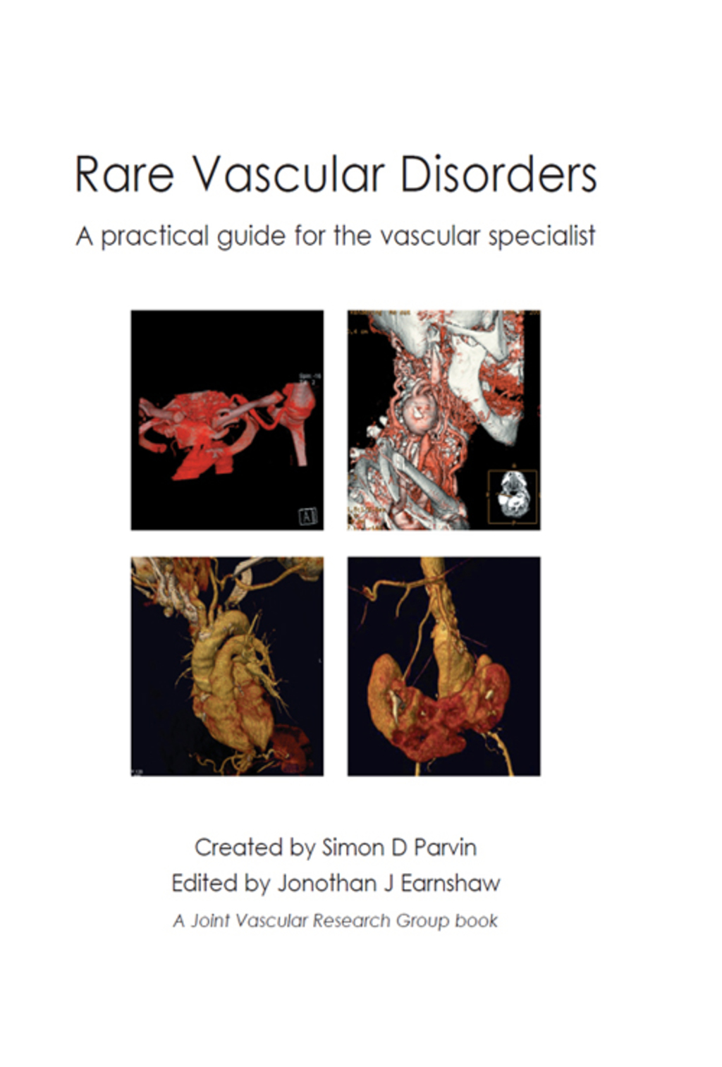 Rare Vascular Disorders 1st Edition