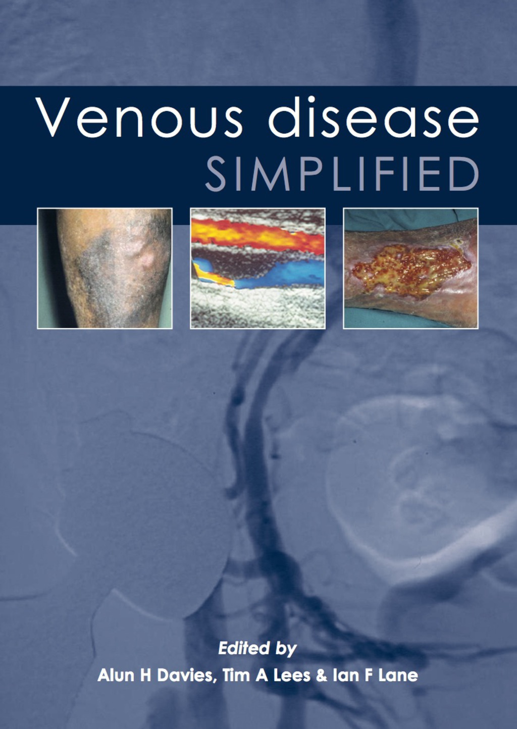 Venous Disease Simplified 1st Edition