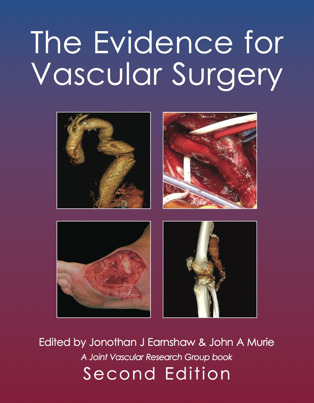 The Evidence for Vascular Surgery; second edition 2nd Edition