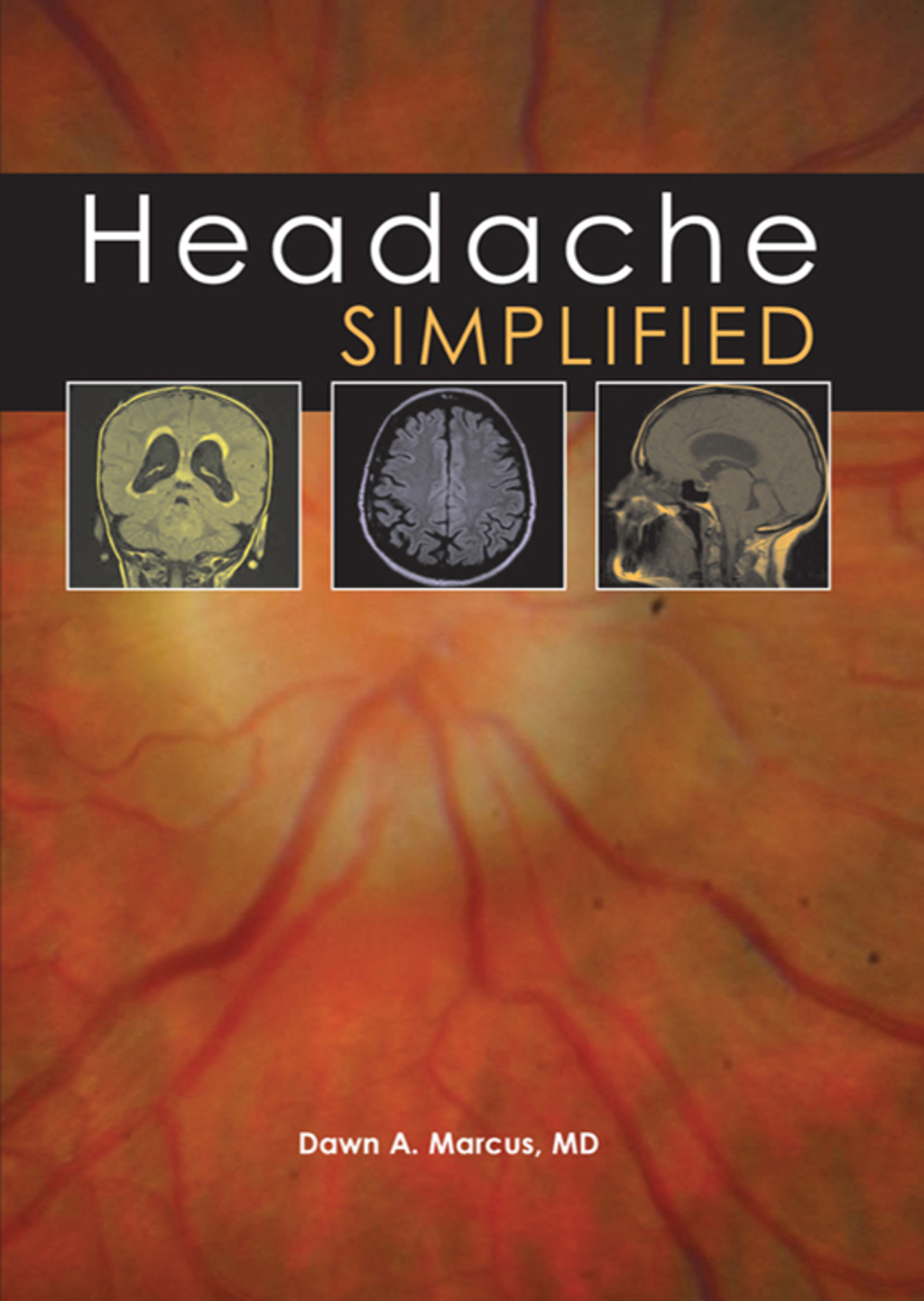 Headache Simplified 1st Edition