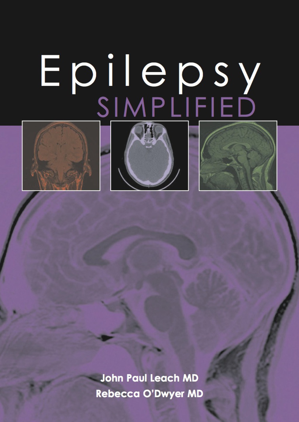 Epilepsy Simplified 1st Edition