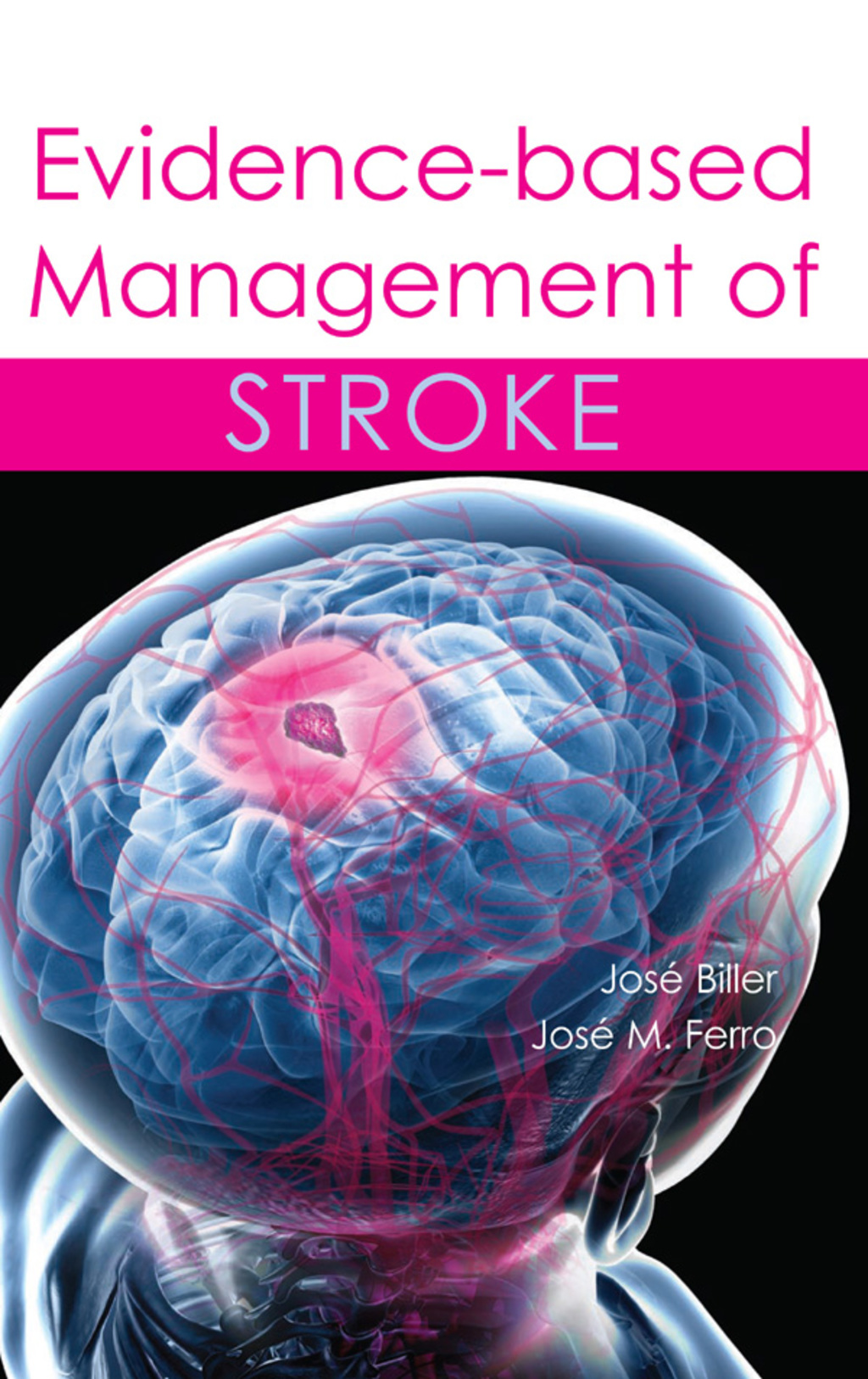 Evidence-based Management of Stroke 1st Edition