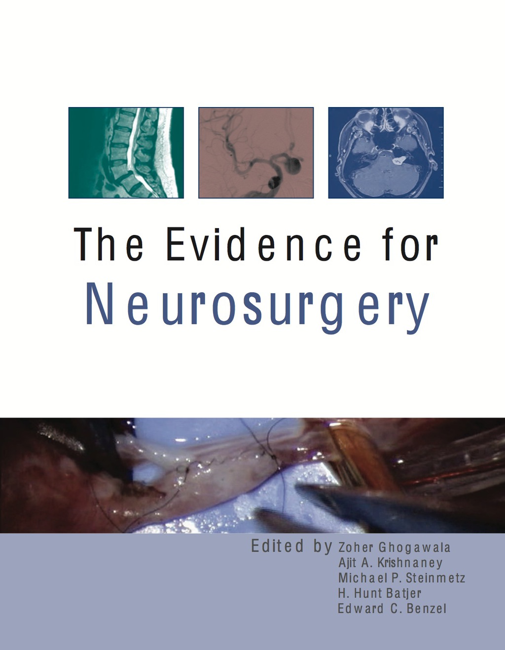 The Evidence for Neurosurgery 1st Edition