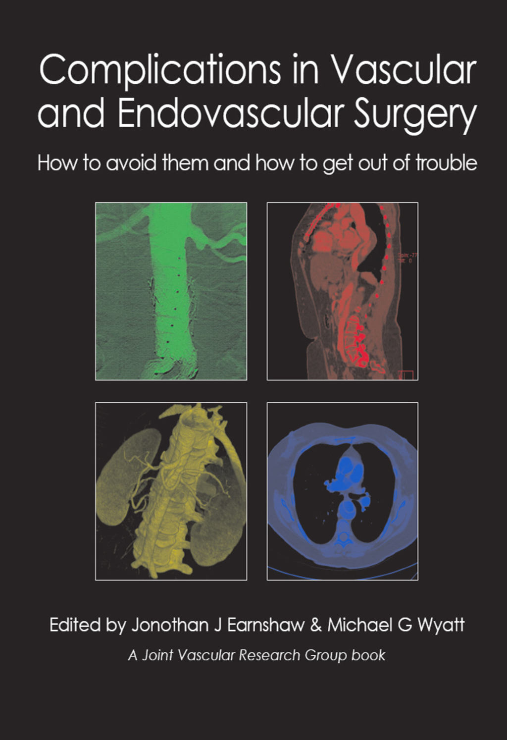 Complications in Vascular and Endovascular Surgery 1st Edition