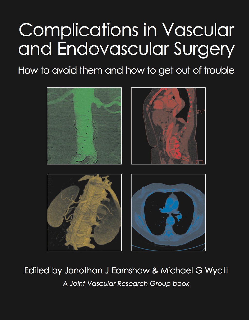 Complications in Vascular and Endovascular Surgery 1st Edition