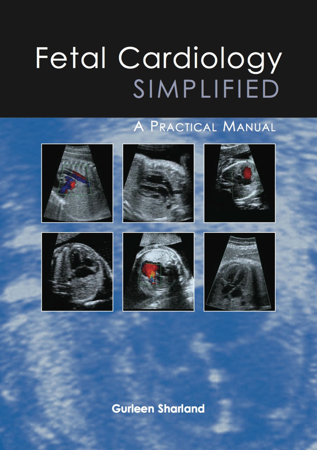 Fetal Cardiology Simplified 1st Edition