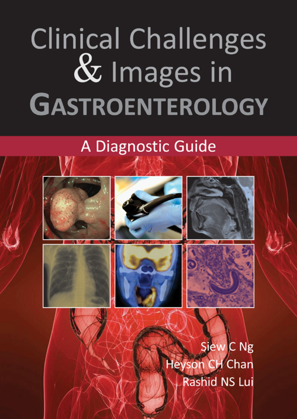 Clinical Challenges & Images in Gastroenterology 1st Edition