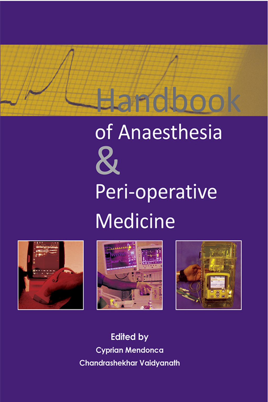 Handbook of Anaesthesia & Peri-operative Medicine 1st Edition