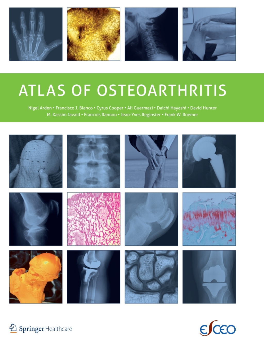 Atlas of Osteoarthritis 