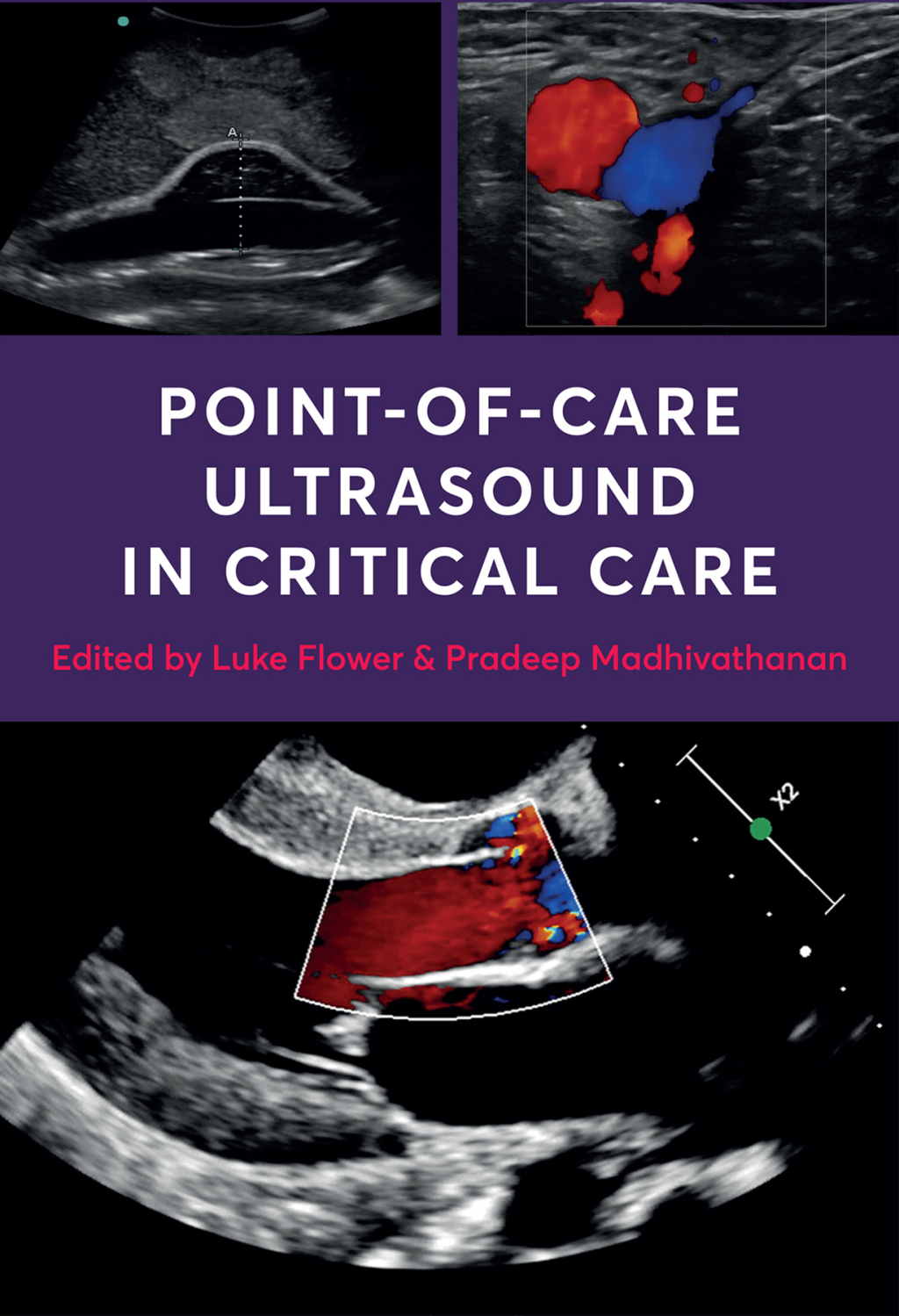 Point-of-Care Ultrasound in Critical Care 