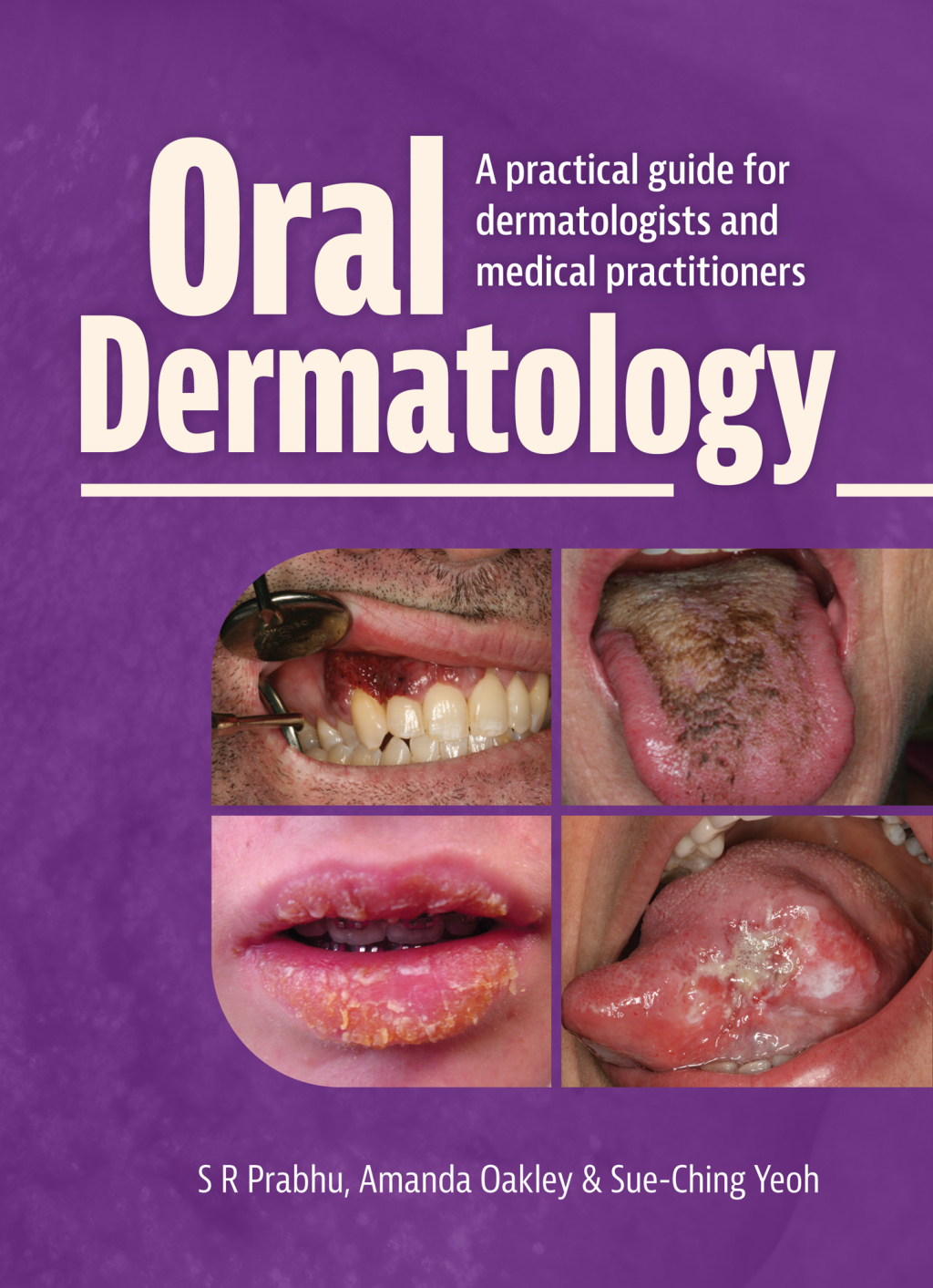 Oral Dermatology A practical guide for dermatologists and medical practitioners 