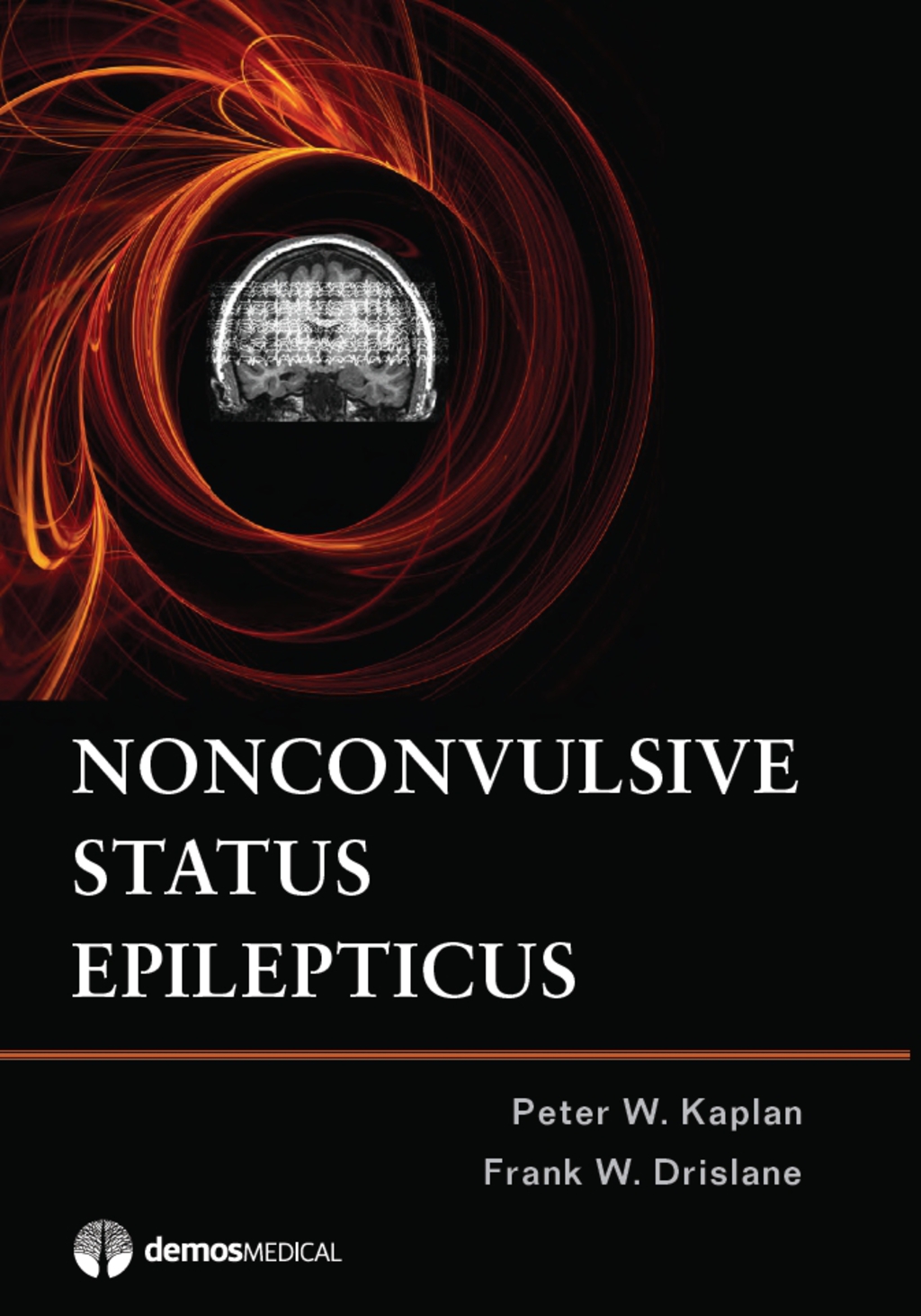 Nonconvulsive Status Epilepticus 1st Edition