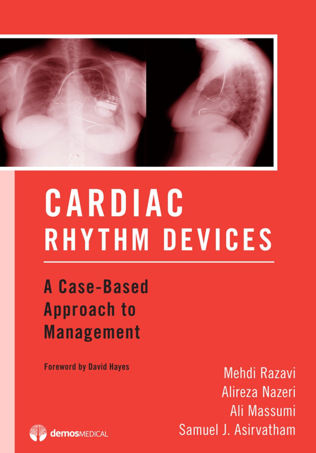 Cardiac Rhythm Devices A Case-Based Approach to Management 1st Edition