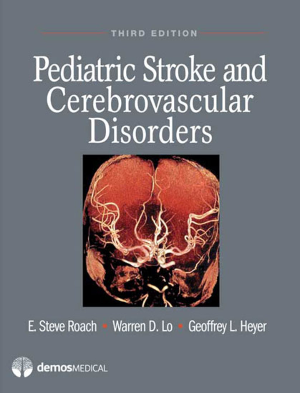 Pediatric Stroke and Cerebrovascular Disorders 1st Edition