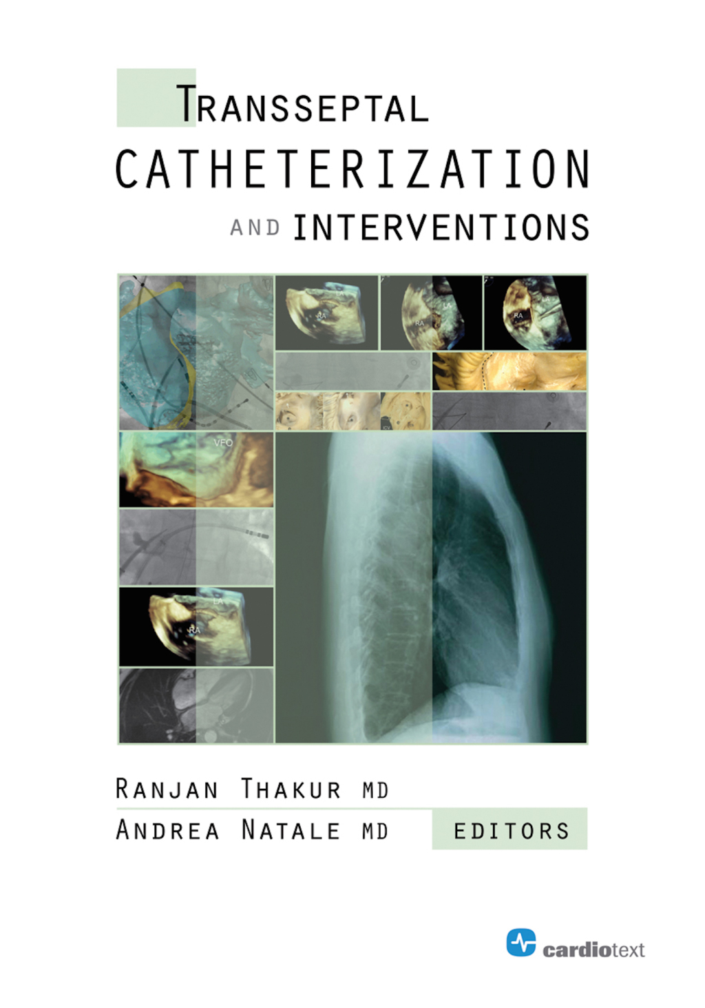 Transseptal Catheterization and Interventions 1st Edition