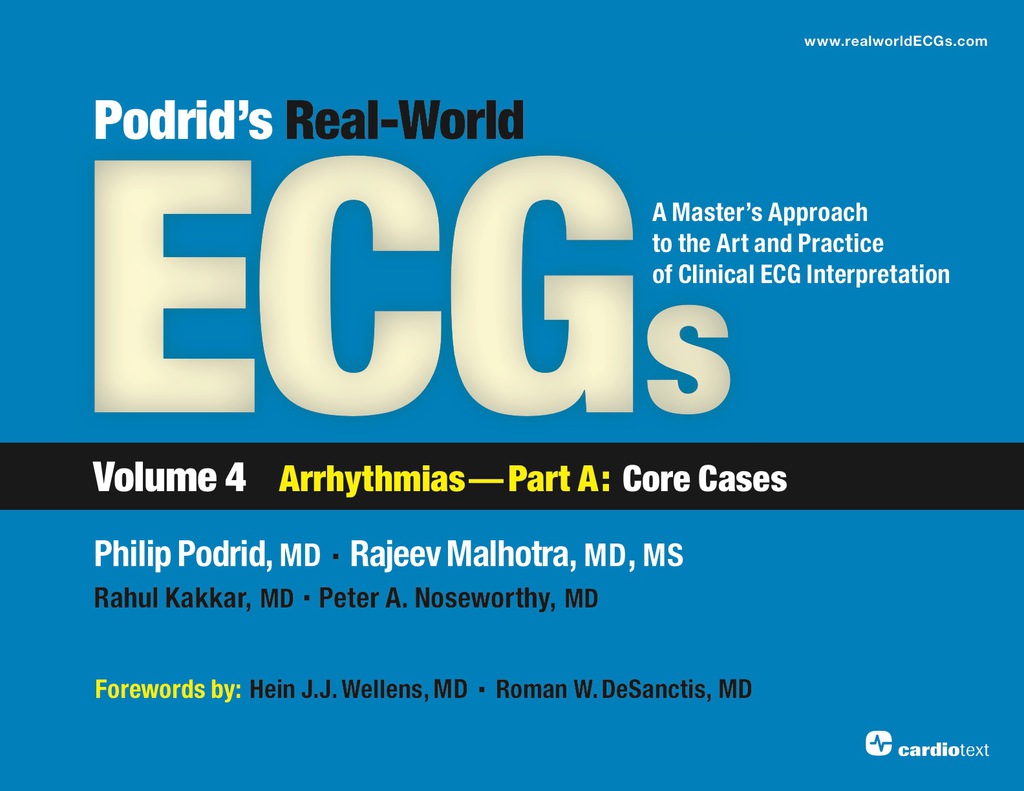 Podrid's Real-World ECGs: Volume 4A, Arrhythmias [Core Cases] 1st Edition