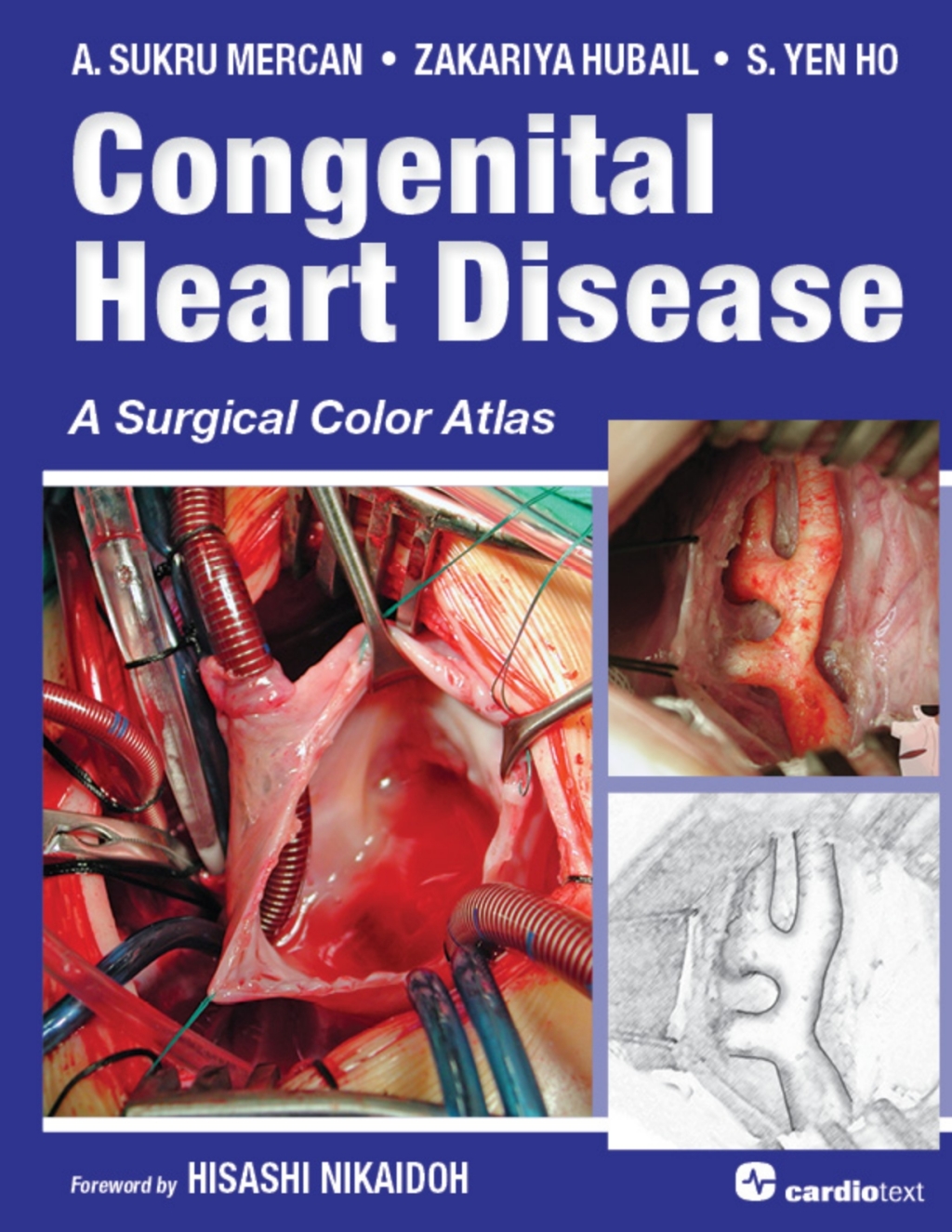Congenital Heart Disease: A Surgical Color Atlas A Surgical Color Atlas 1st Edition