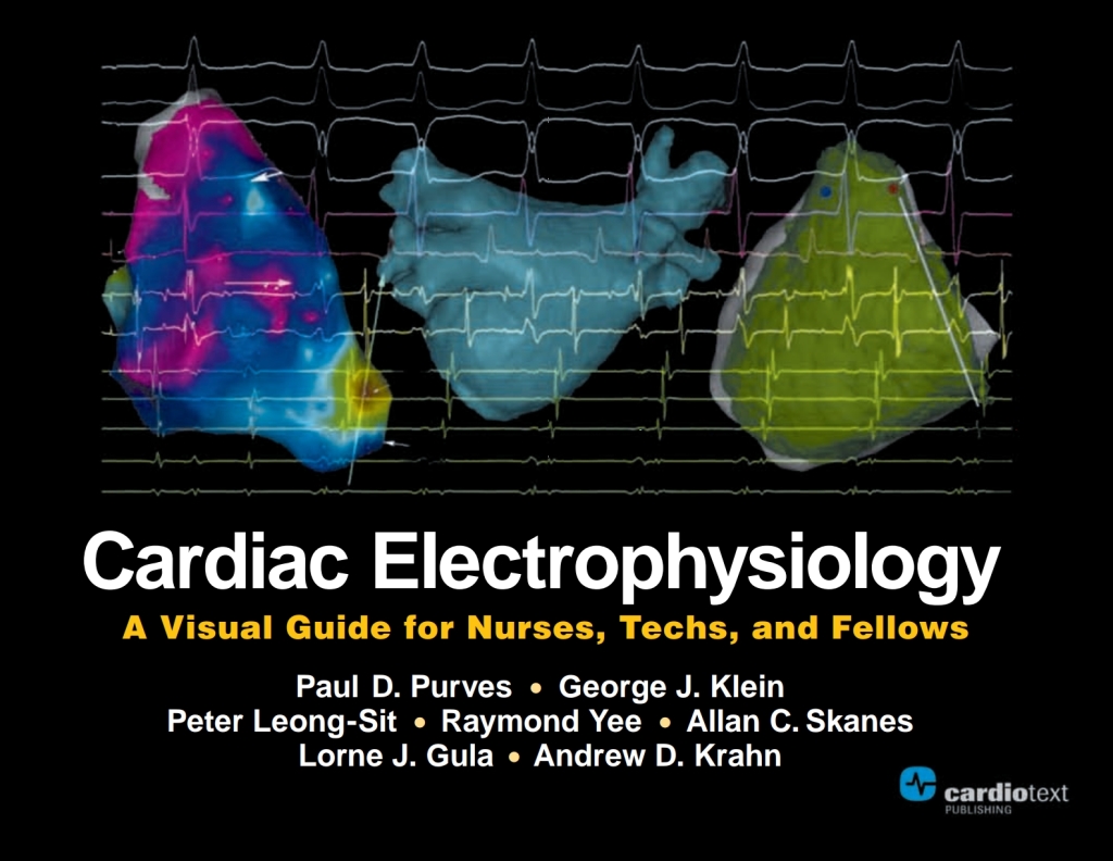 Cardiac Electrophysiology: A Visual Guide for Nurses, Techs, and Fellows 1st Edition