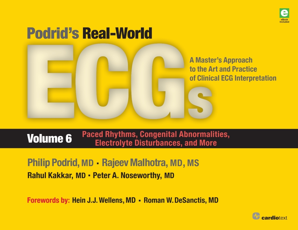 Podrid's Real-World ECGs: Volume 6, Paced Rhythms, Congenital Abnormalities, Electrolyte Disturbances, and More A Master's Approach to the Art and Practice of Clinical ECG Interpretation 1st Edition