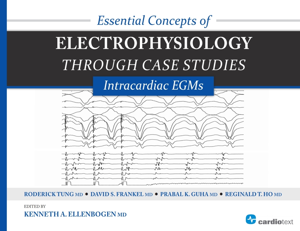 Essential Concepts of Electrophysiology through Case Studies: Intracardiac EGMs Intracardiac EGMs 1st Edition