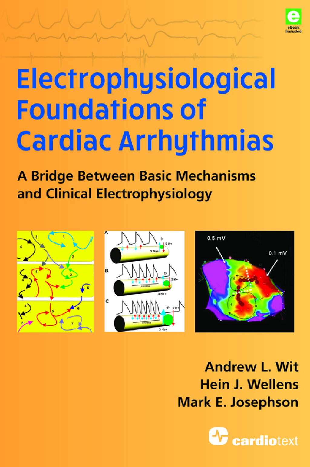 Electrophysiological Foundations of Cardiac Arrhythmias A Bridge Between Basic Mechanisms and Clinical Electrophysiology 1st Edition