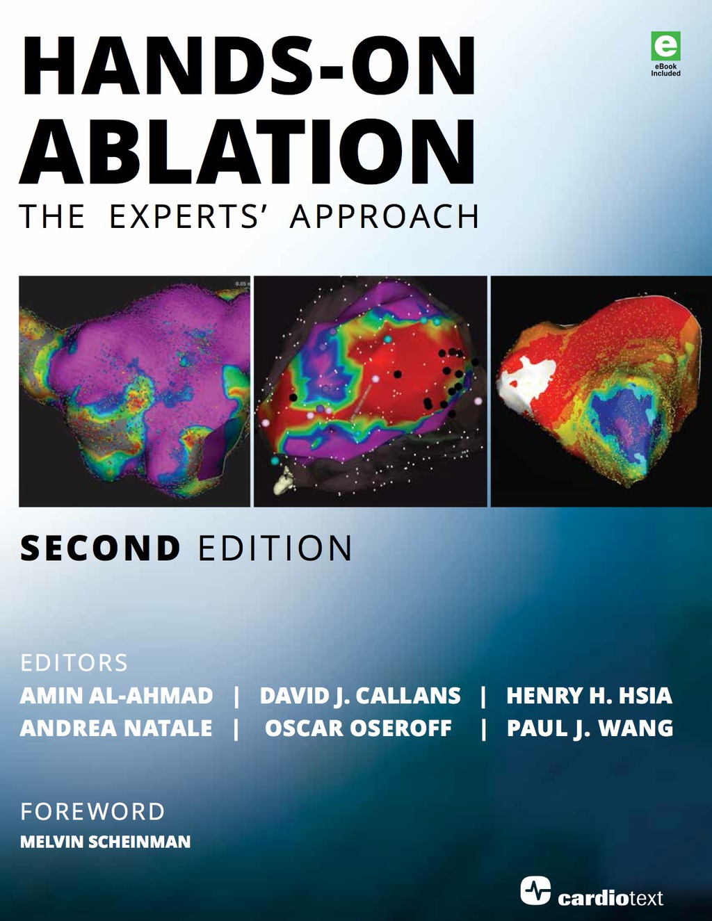 Hands-On Ablation The Experts' Approach, Second Edition 2nd Edition