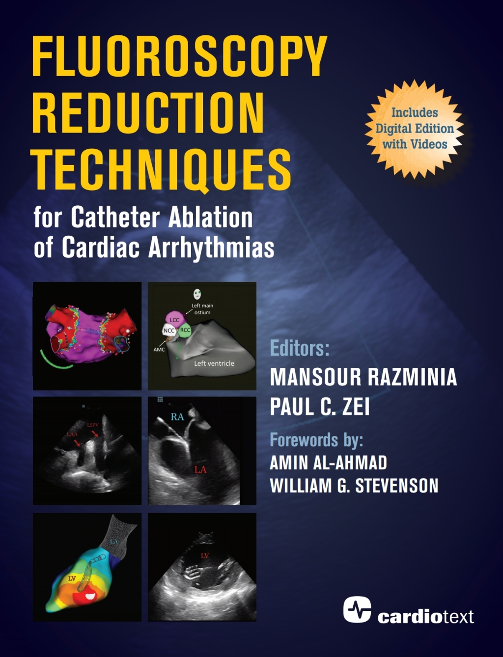 Fluoroscopy Reduction Techniques for Catheter Ablation of Cardiac Arrhythmias 1st Edition