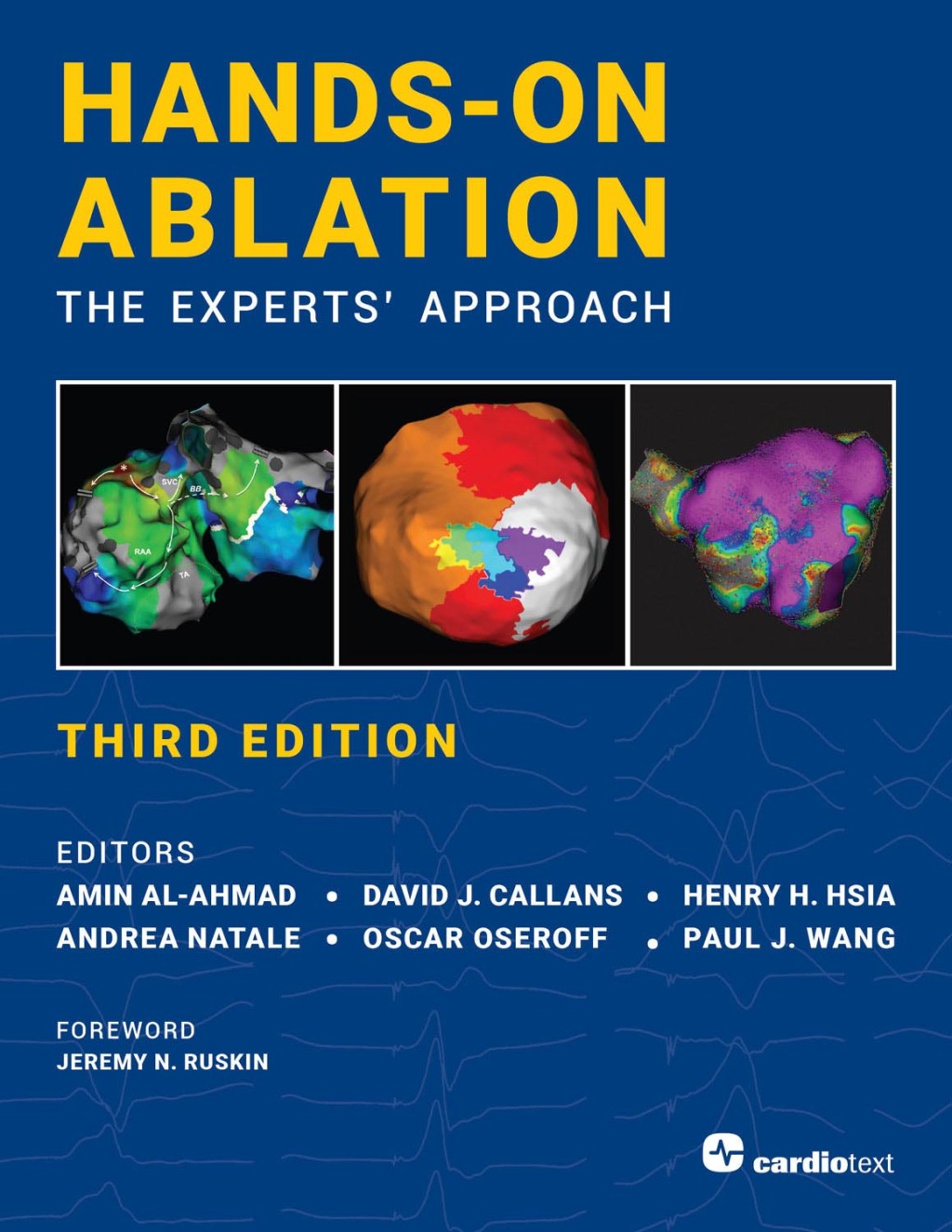 Hands-On Ablation, The Experts' Approach, Third Edition 3rd Edition