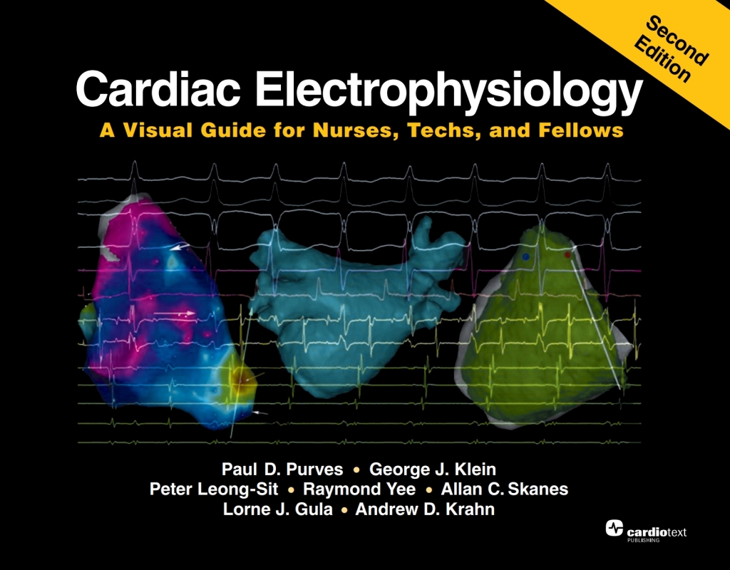 Cardiac Electrophysiology: A Visual Guide for Nurses, Techs, and Fellows, Second Edition 2nd Edition