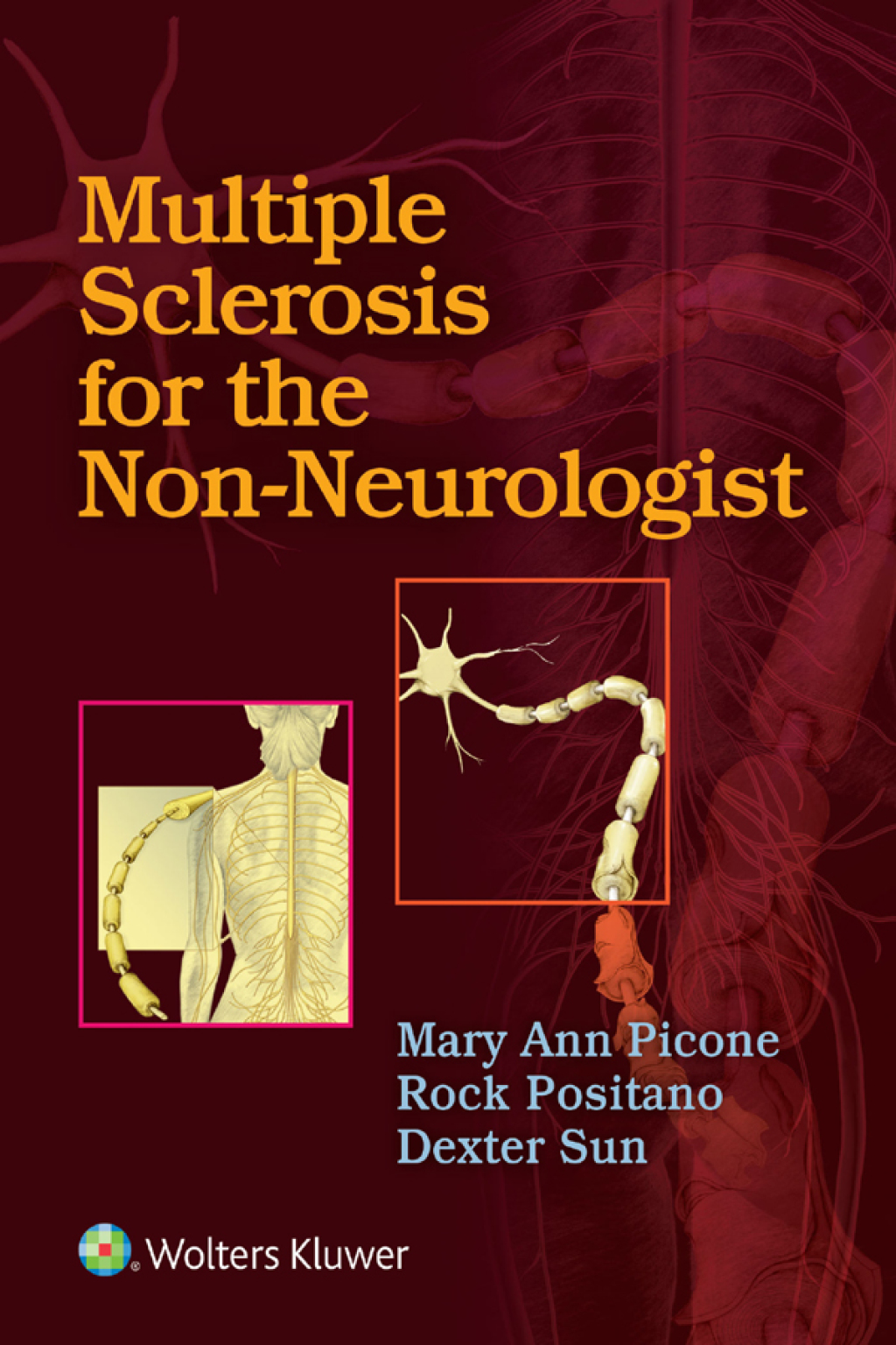 Multiple Sclerosis for the Non-Neurologist 