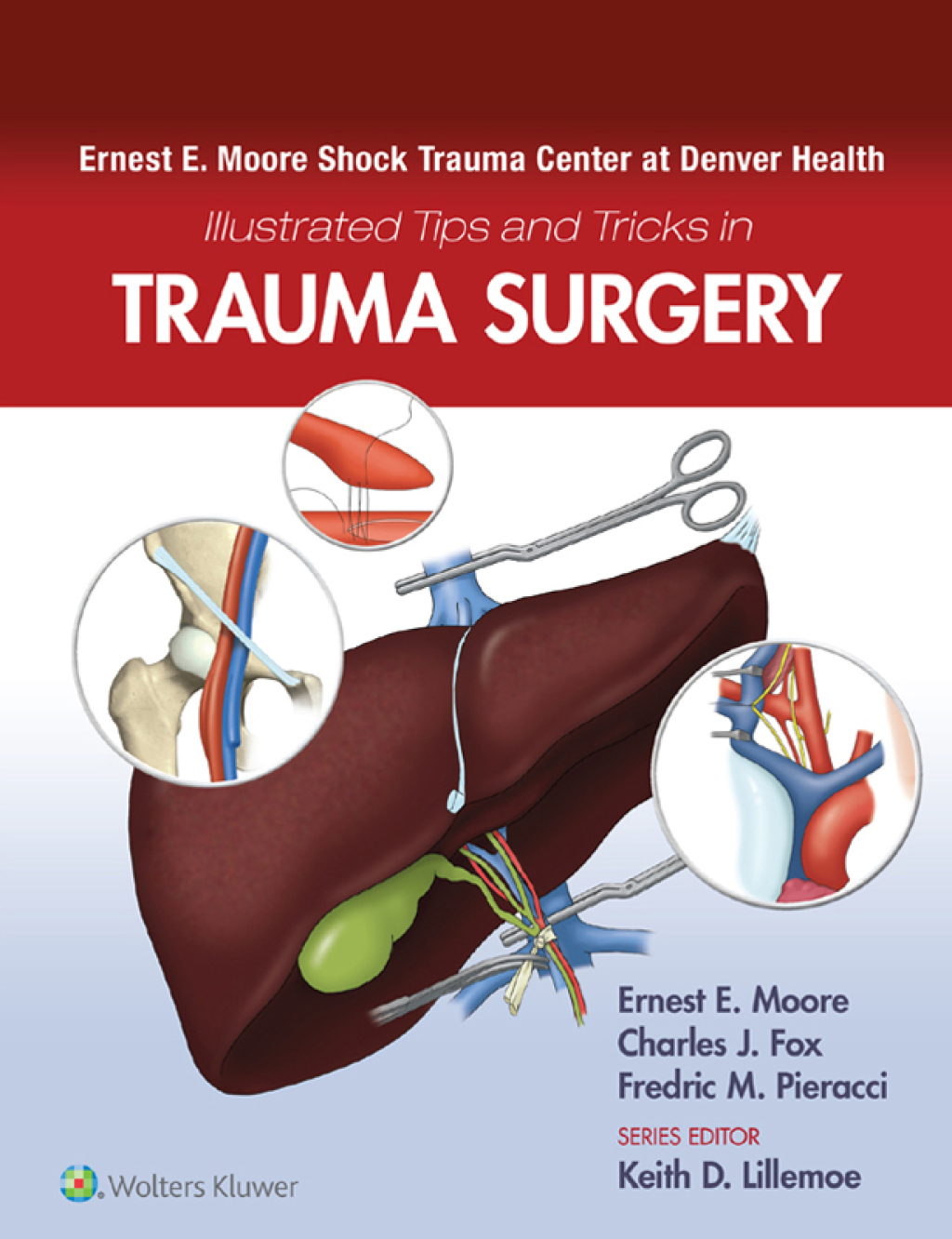 Ernest E. Moore Shock Trauma Center at Denver Health Illustrated Tips and Tricks in Trauma Surgery 1st Edition