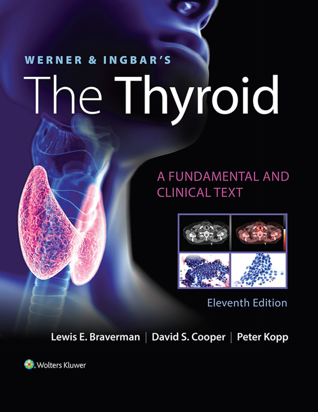 Werner & Ingbar's The Thyroid 11th Edition