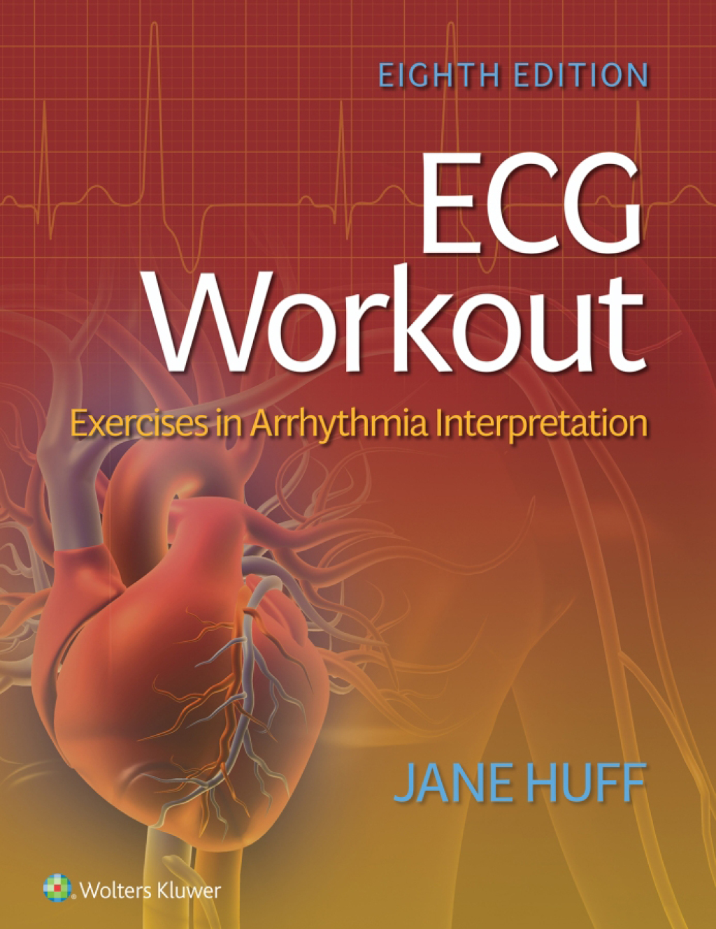 ECG Workout Exercises in Arrhythmia Interpretation 8th Edition