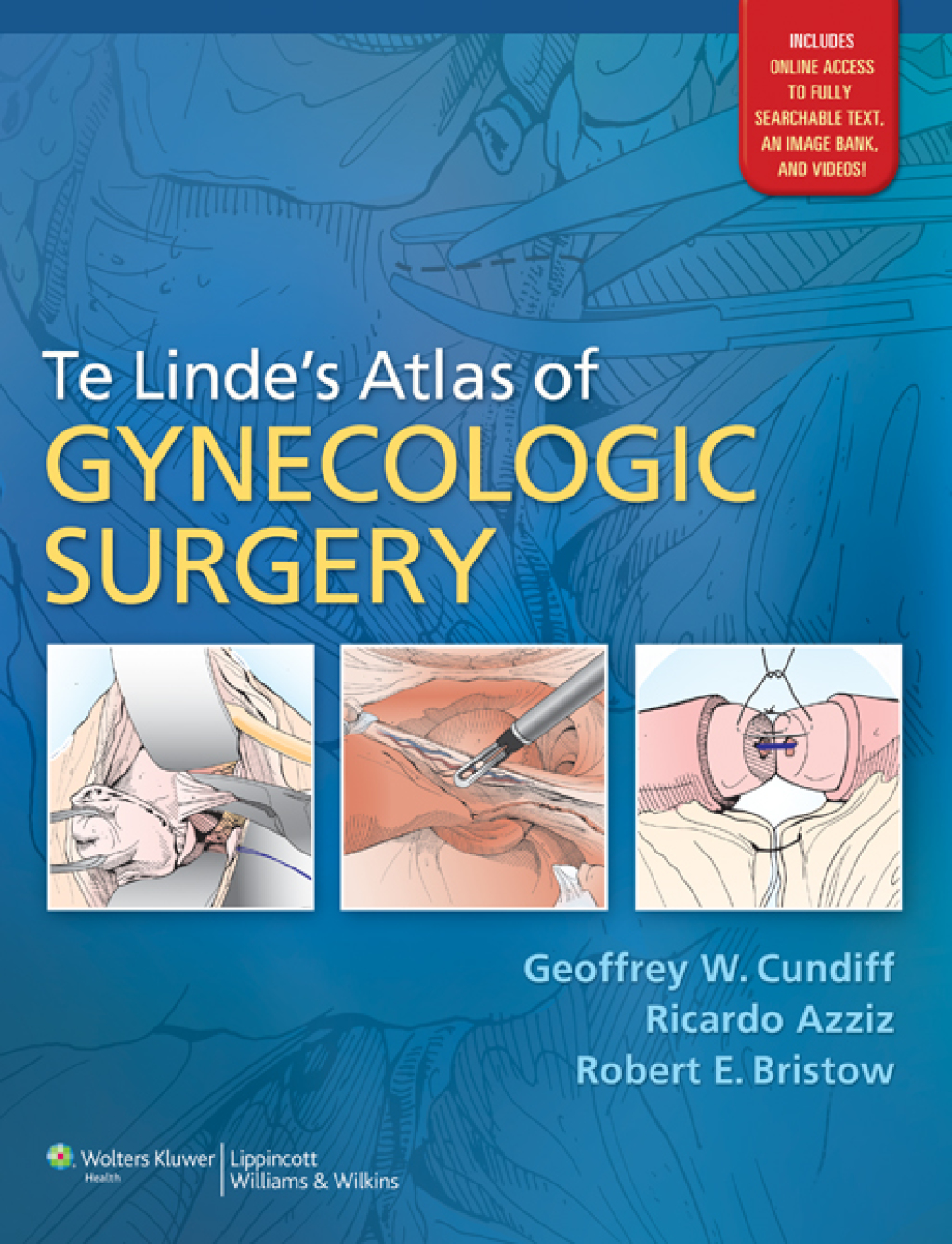 Te Linde's Atlas of Gynecologic Surgery 1st Edition