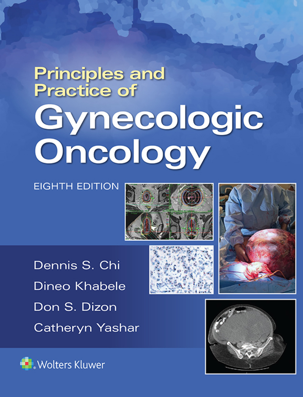 Principles and Practice of Gynecologic Oncology 8th Edition