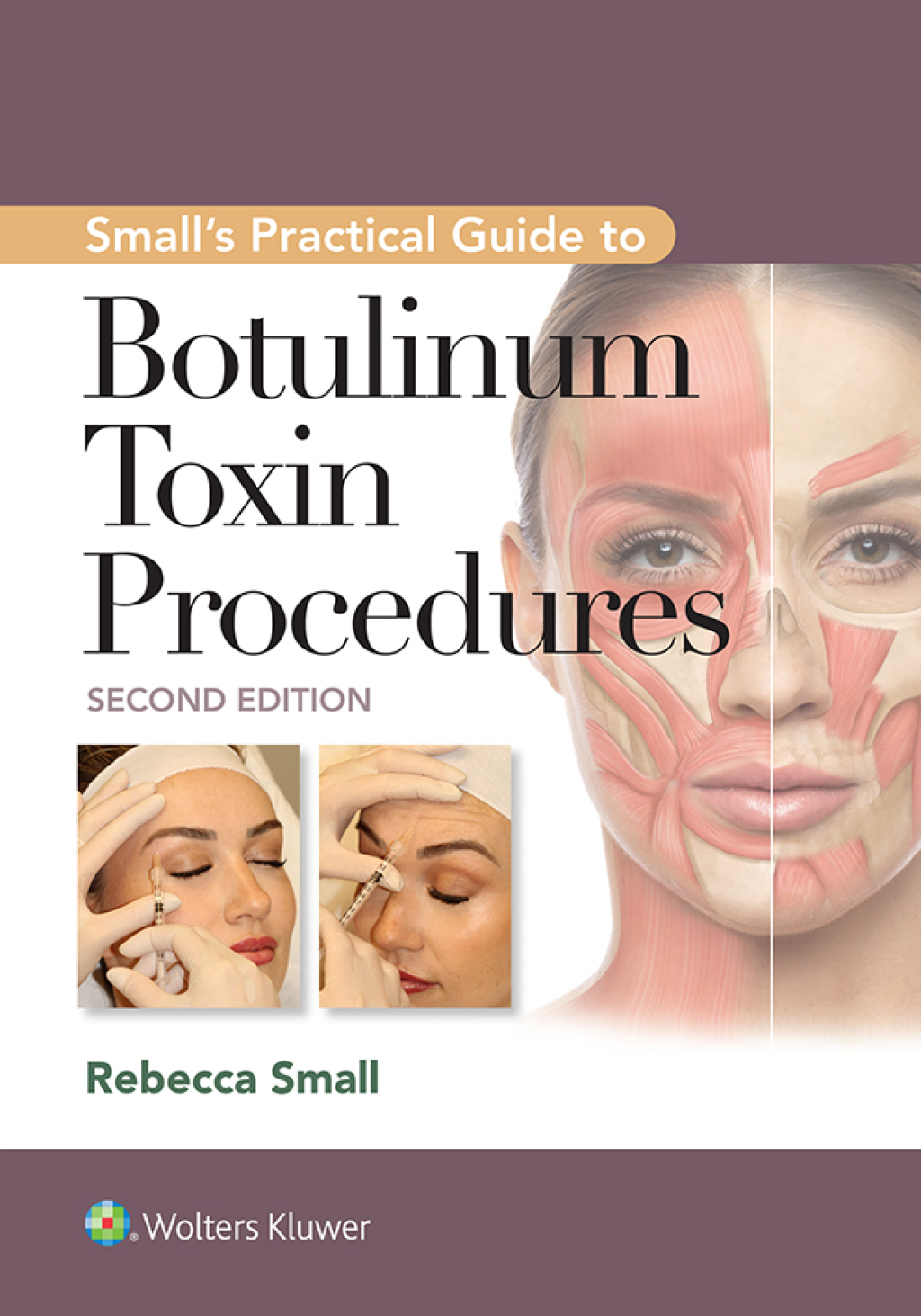 Small's Practical Guide to Botulinum Toxin Procedures 2nd Edition