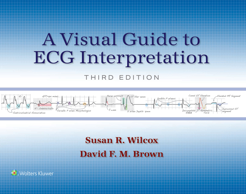 A Visual Guide to ECG Interpretation 3rd Edition