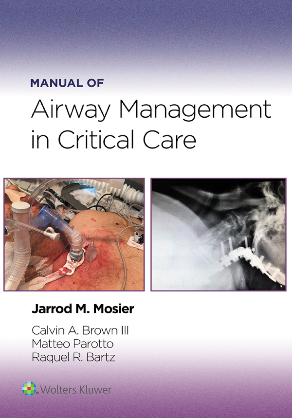 Manual of Airway Management in Critical Care eBook with Multimedia 1st Edition