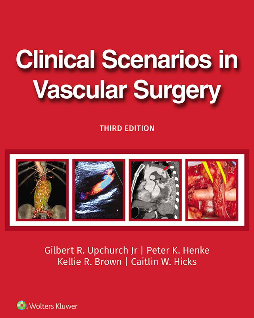 Clinical Scenarios in Vascular Surgery 3rd Edition