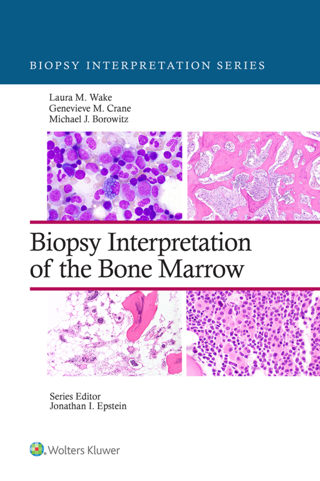 Biopsy Interpretation of the Bone Marrow 1st Edition