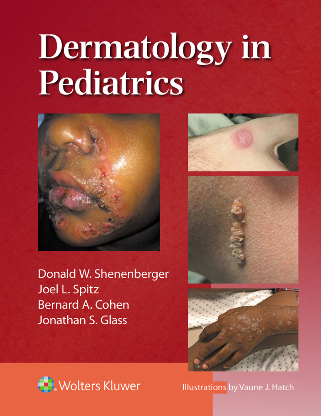 Dermatology in Pediatrics 1st Edition