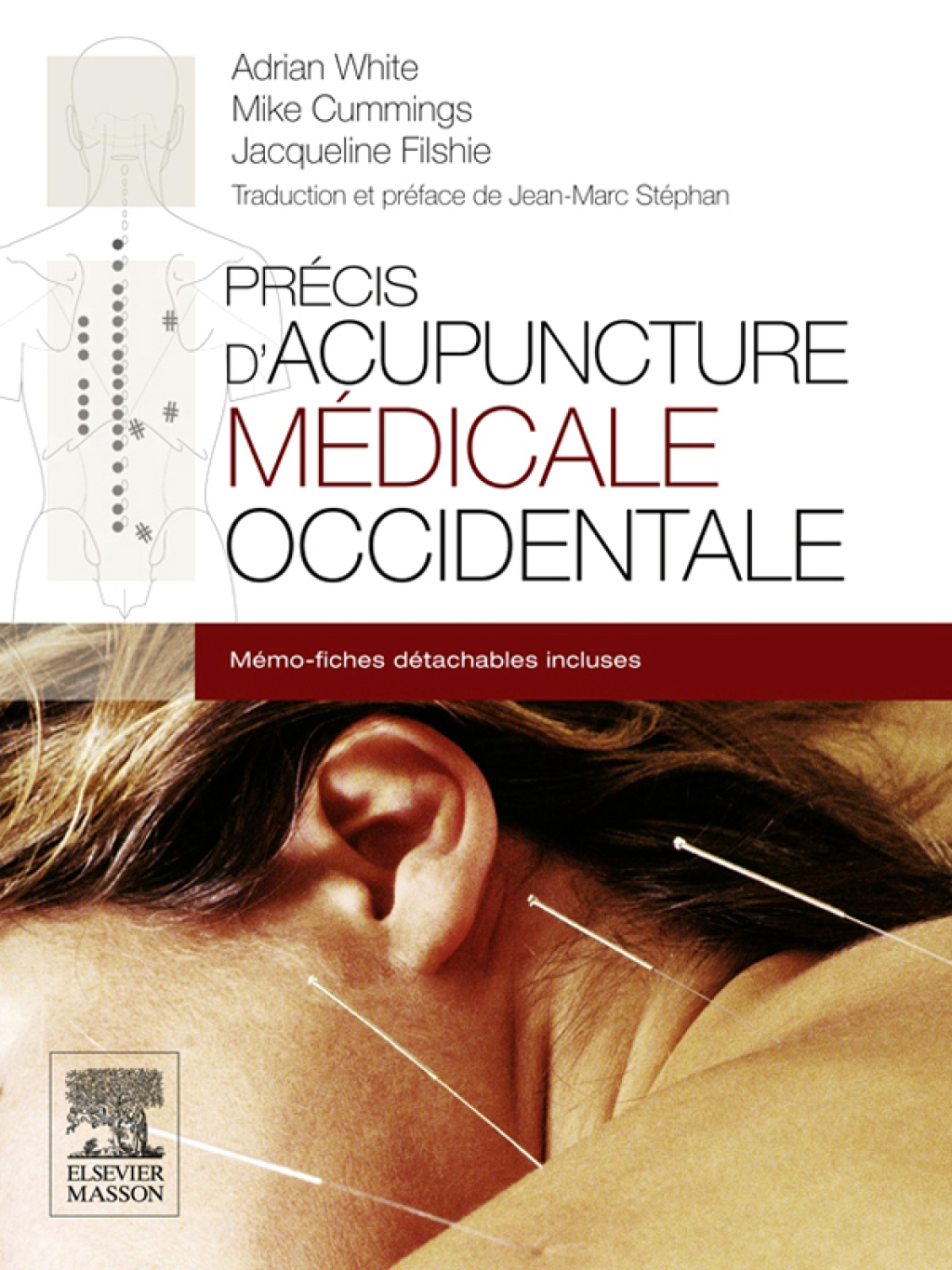 PrÃƒÂ©cis d'acupuncture mÃƒÂ©dicale occidentale 