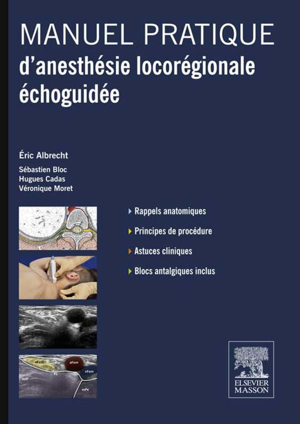 Manuel pratique dÃ¢â‚¬â„¢anesthÃƒÂ©sie locorÃƒÂ©gionale ÃƒÂ©choguidÃƒÂ©e 