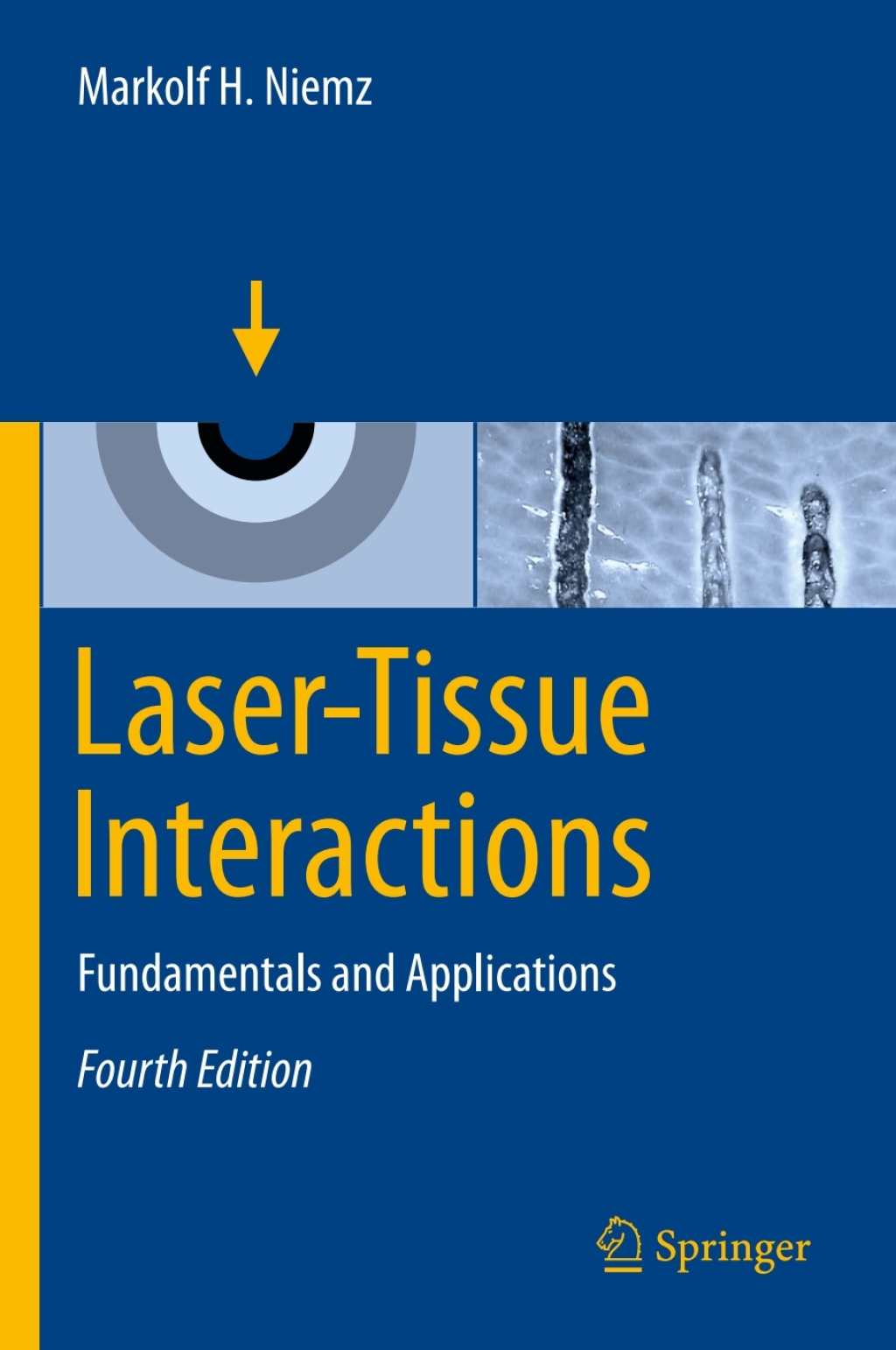 Laser-Tissue Interactions Fundamentals and Applications 4th Edition