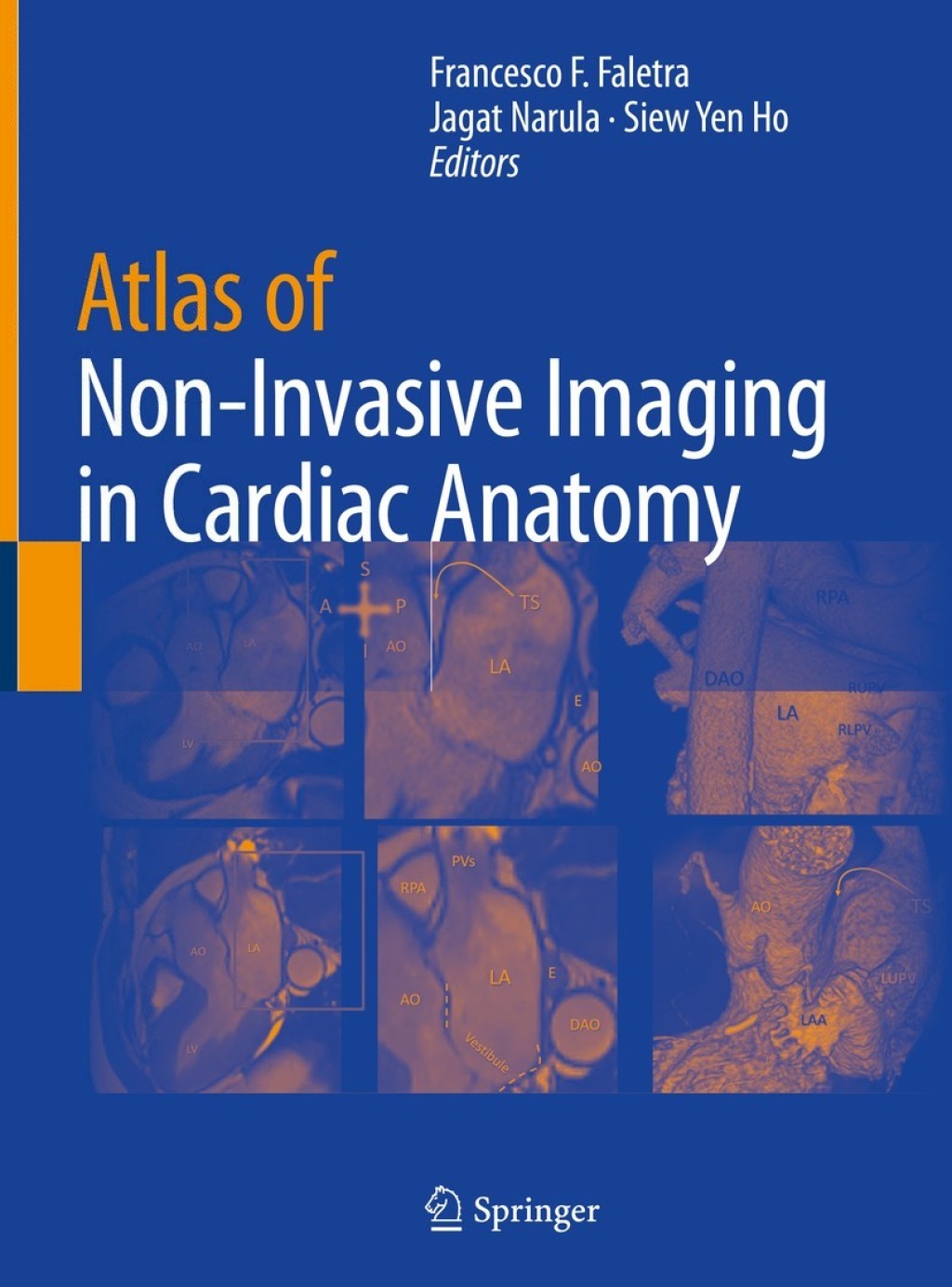 Atlas of Non-Invasive Imaging in Cardiac Anatomy 1st Edition