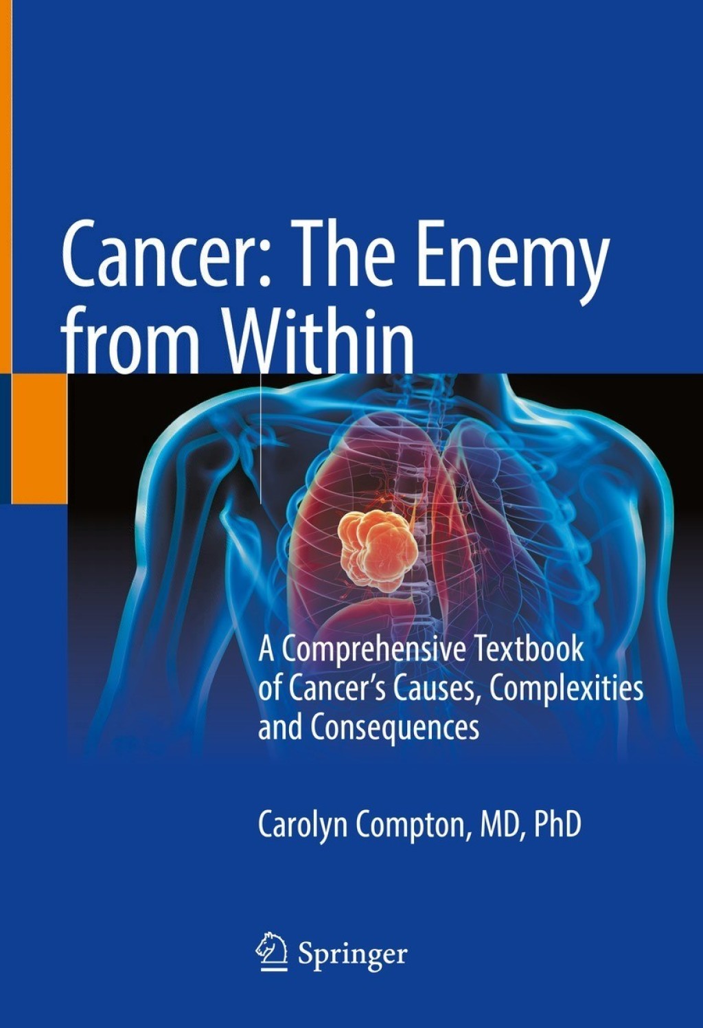 Cancer: The Enemy from Within A Comprehensive Textbook of CancerÃ¢â‚¬â„¢s Causes, Complexities and Consequences 